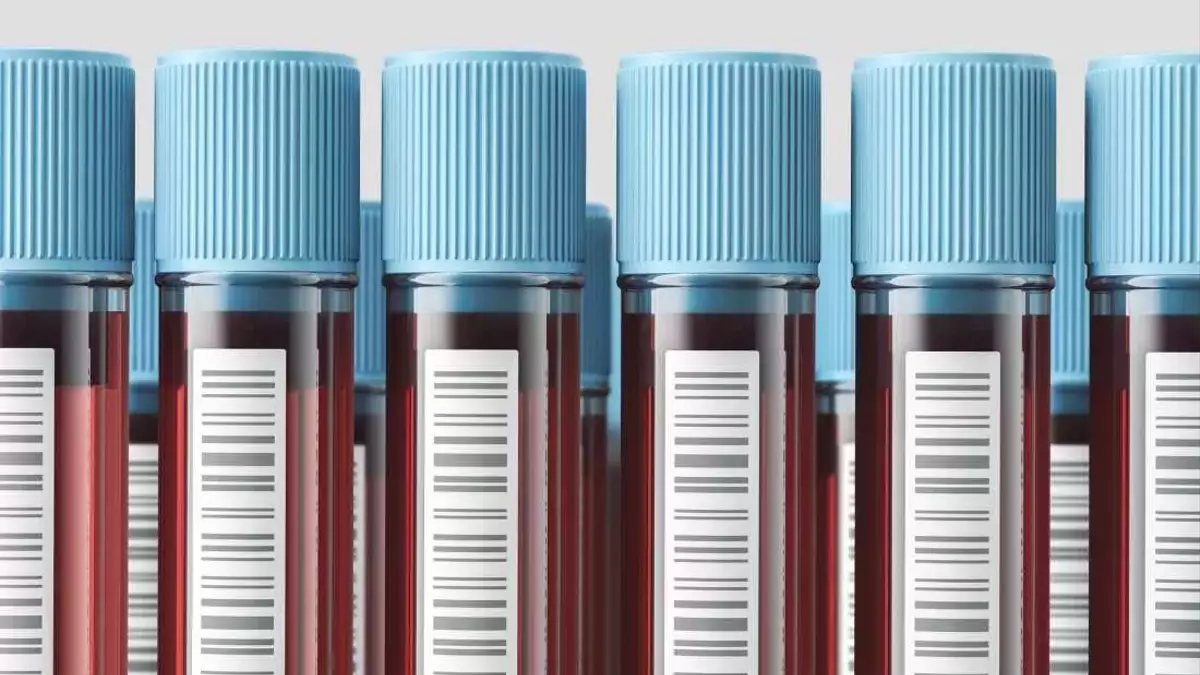 Direct-to-Consumer Blood Testing: Empowerment or Peril?
