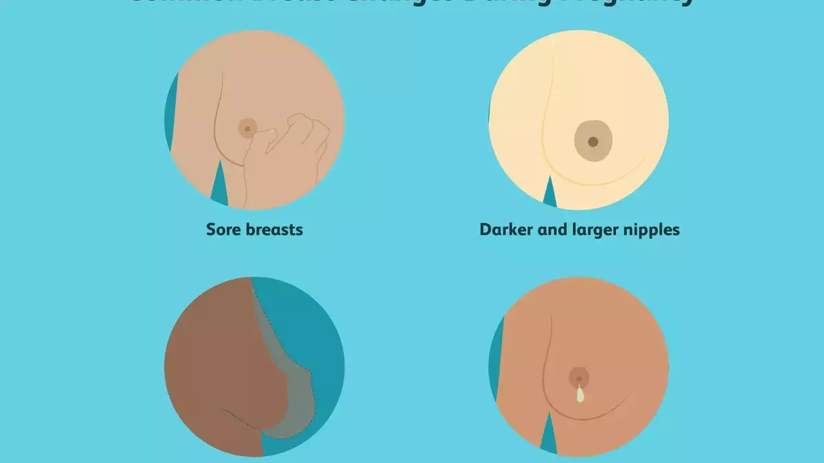 Understanding Breast Transformations During Pregnancy: A Comprehensive Guide