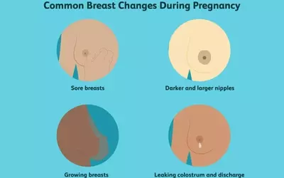Understanding Breast Transformations During Pregnancy: A Comprehensive Guide