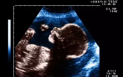 The Art and Impact of Pregnancy Nicknames