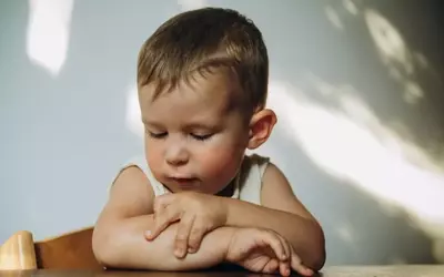 Understanding and Managing Eczema in Children