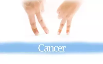 TransCode's RNA Therapeutic Shows Promise in Colorectal Cancer Trial