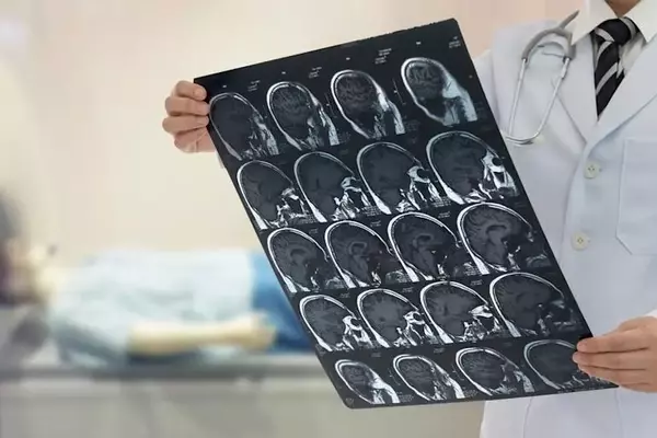 NeurAxis (NRXS) Shares Rise Amid Favorable Reimbursement & Guideline Developments