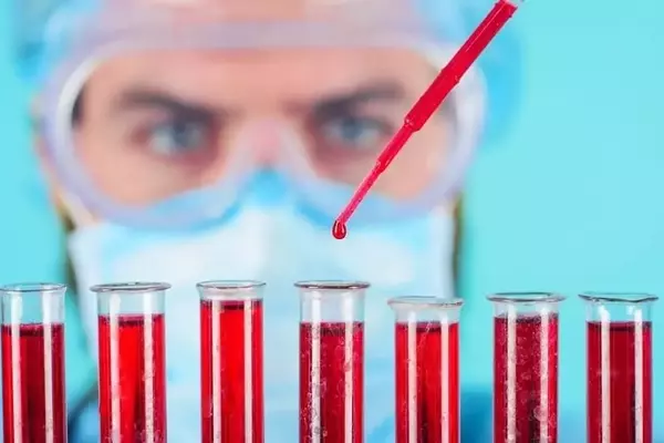 Immix Biopharma: Analyst Bullish but Flags Safety and Adoption Questions